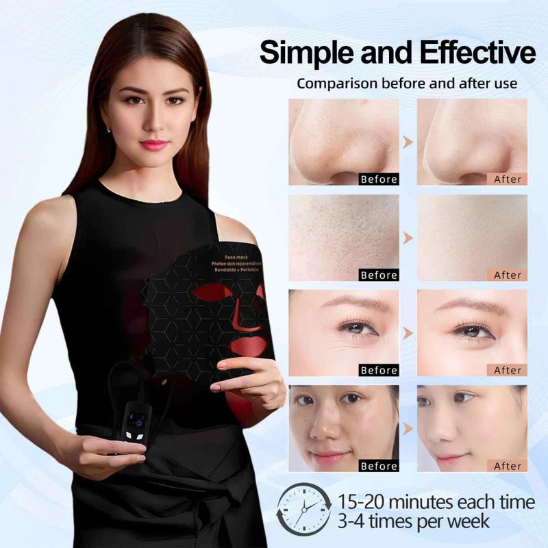 Portable LED Light Therapy Face Mask